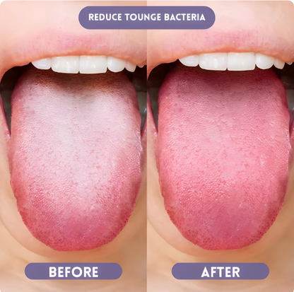 Fascean Probiotic Oral Spray